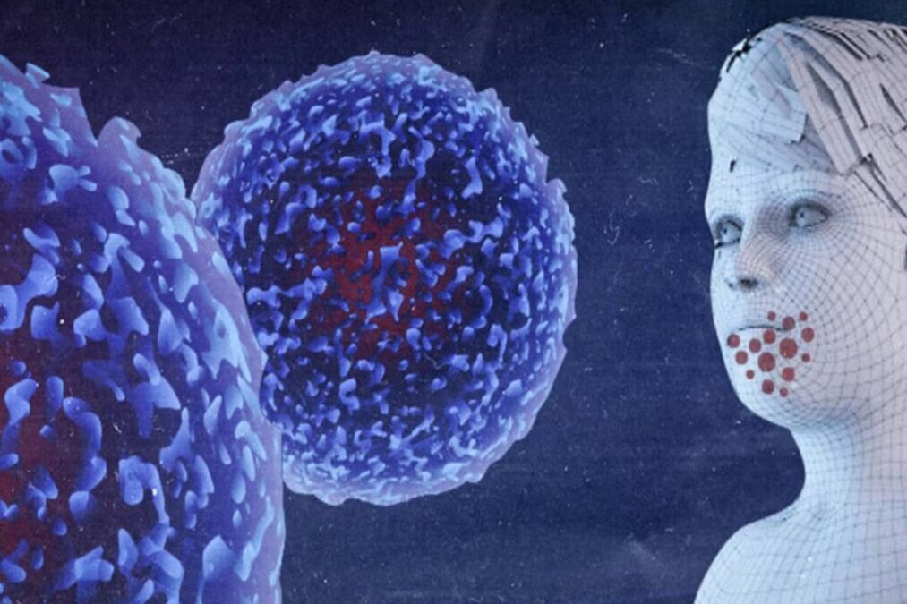 Alerta sobre o vírus Coxsackie se espalhando entre crianças: o que ele causa e quão sério é