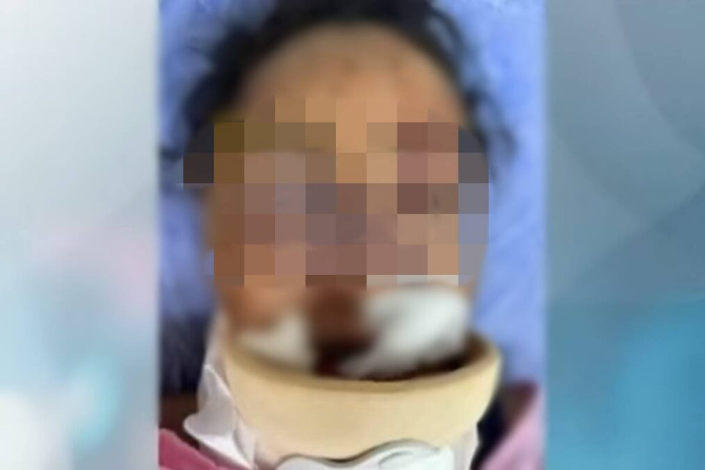 Mulher está internada em Camaçari