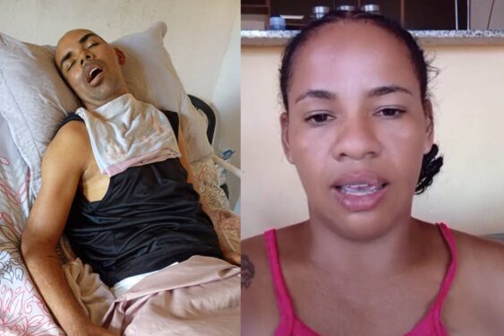 Homem de 41 anos enfrenta grave infecção dentária e esposa pede ajuda urgente em Simões Filho